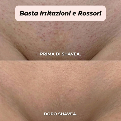 Rasoio 2 in 1 per bikini e corpo Shavino™