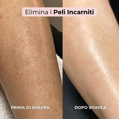 Rasoio 2 in 1 per bikini e corpo Shavino™